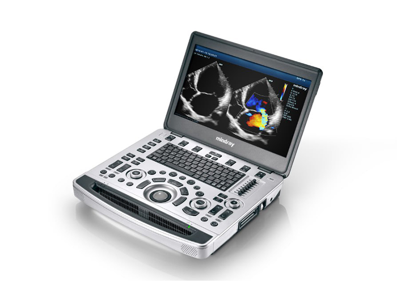 Portable Ultrasound